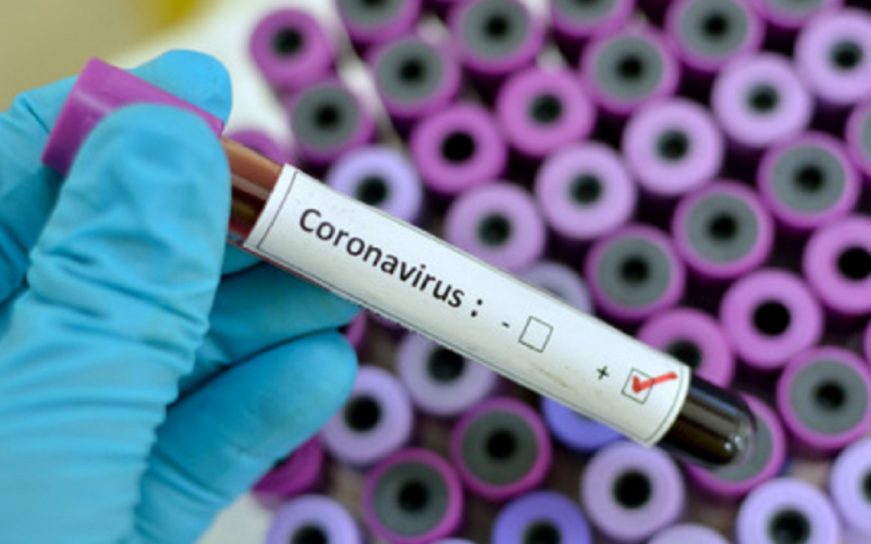 Coronavirus: tre nuovi casi positivi in provincia, nessuno contagio a Gela